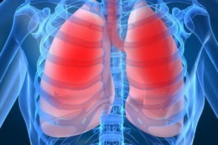 Minden tizedik ember halálát tüdőbetegség okozza