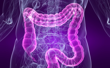 Hogyan előzhető meg a vastagbélrák? 