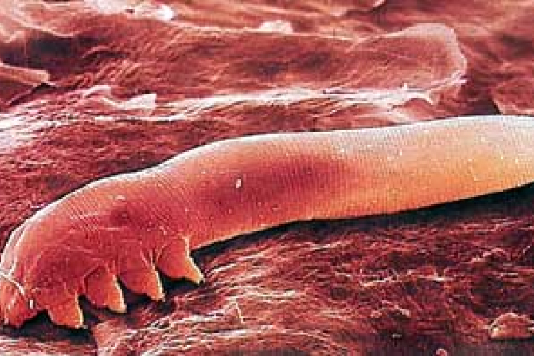 Az arcon élő atka is okozhat pattanásokat